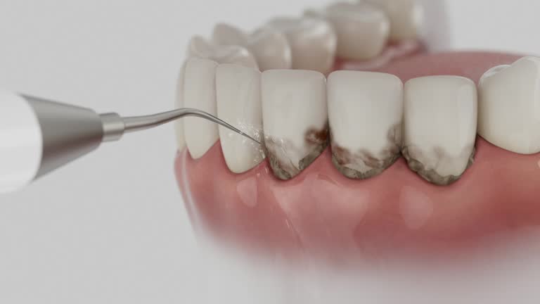Trusted Tooth Extraction service in Biscayne Park, FL - Dentist Open Now
